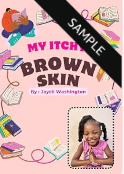 MY ITCHY BROWN SKIN